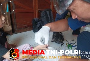 Damkarmat Kotim Berhasil Lepaskan Cincin yang Jepit Jari Bocah dalam Waktu Tujuh Menit